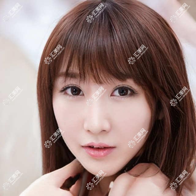 兰州牙齿种植医生推荐！冉俊杰、葛振林、张伟强等名医擅长种植，技术精细，口碑良好！