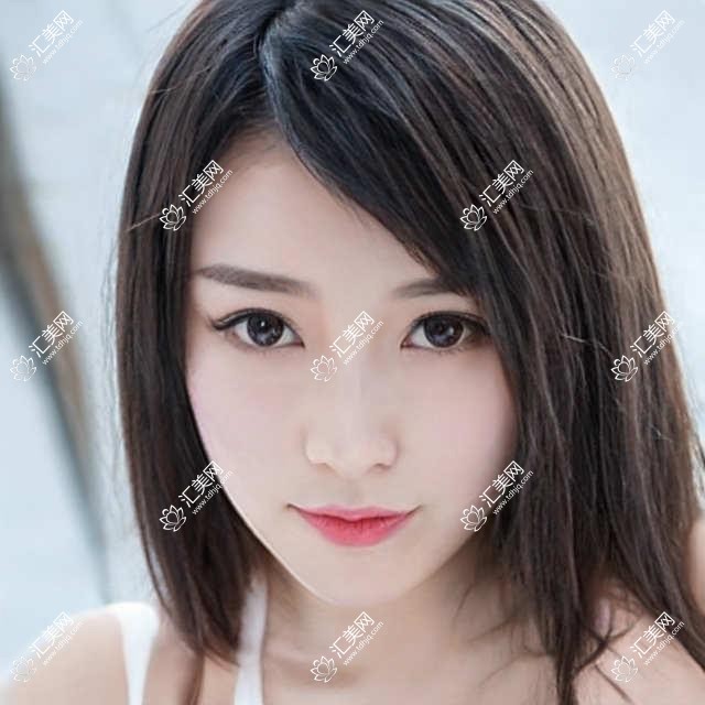 广州华厦眼科全项目价格表:近视准分子激光8800+