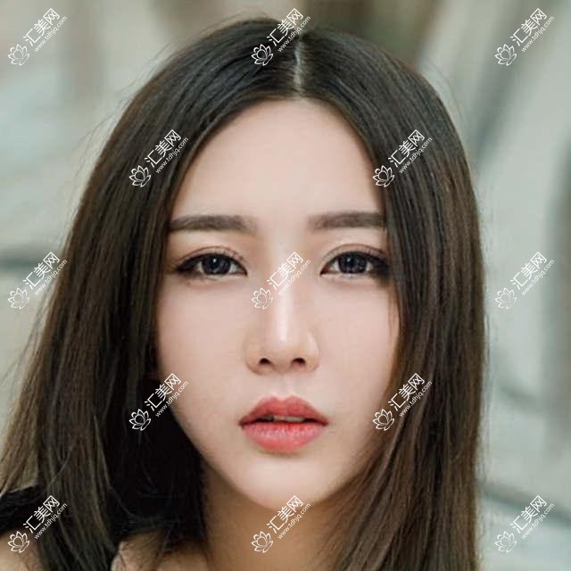 探访邢台韩伟强孙兰娟高健等医美医生,解锁皮肤眼部鼻部整形新魅力