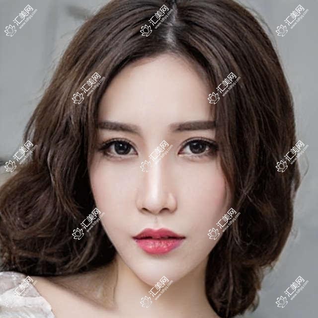 天津维美医美多少钱?双眼皮8K+隆鼻1.5W+3K+