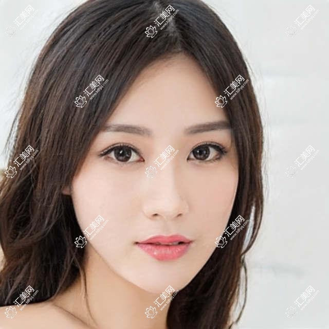 北京近视手术医生推荐：翟长斌、卢炜、何伟，精通全飞秒、半飞秒及激光手术