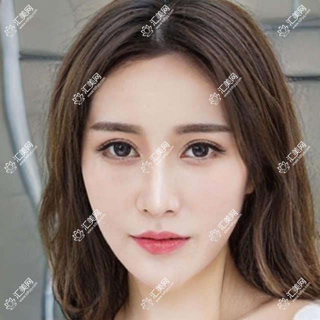 北京美和眼科全攻略:热门眼科项目价格大揭秘