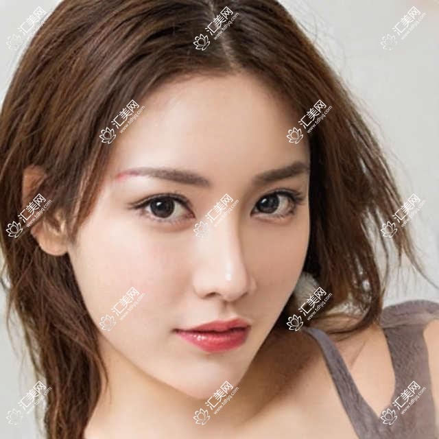 南宁眼科医生排名推荐(含优势项目+费用)_近视手术优选医生