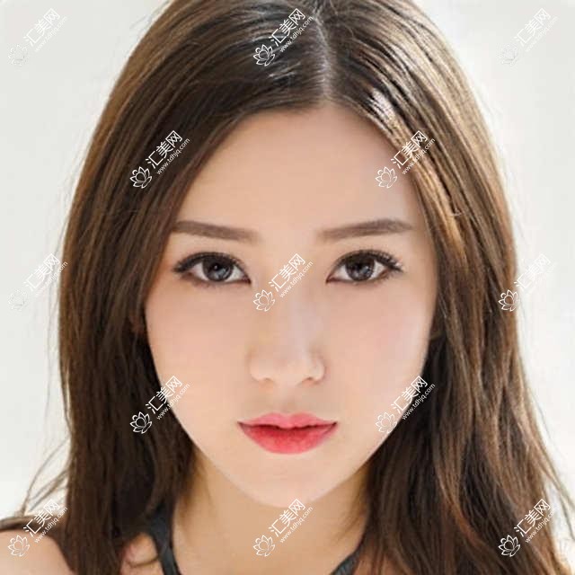 佛山希玛眼科近视矫正费用揭秘?全飞秒近视手术约1W+、半飞秒亲民价近1W、ICL晶体植入约3W起
