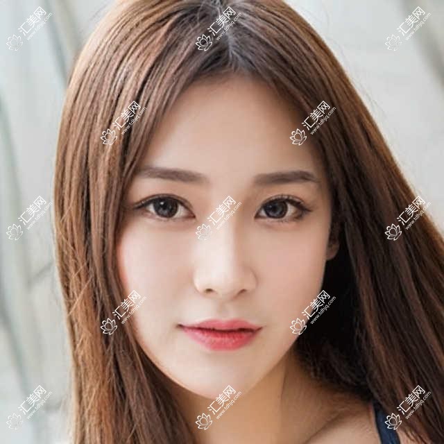 武汉何氏眼科项目价目表:精益眼科白内障超声乳化6800起,斜视矫正12000起,半飞秒激光16800起