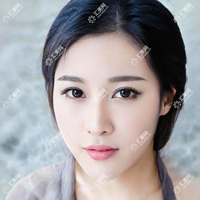 吉林眼科医生孔玉娇、马文玲、夏清艳：稳准治疗白内障、结膜炎受好评