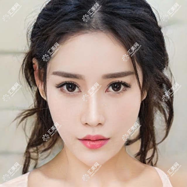 成都青羊萌鹰眼科全项目价格揭秘,2万内搞定,性价比之选!
