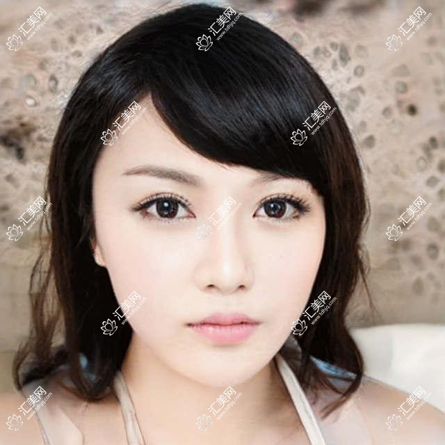 太原全口种植牙哪位医生技术佳?推荐徐子强、马泷、张克三位医生