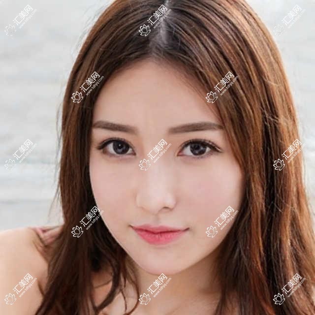 上海市上海医大医院眼科费用概览?近视矫正1W+ 白内障手术2W+ 玻尿酸填充眼周5K+