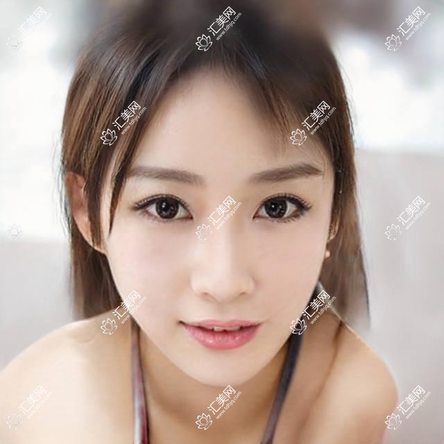 天津长庚眼科全项目价格揭秘!近视激光、白内障手术等热门医美一览