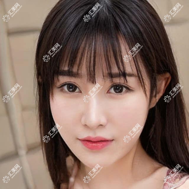 连云港哪位眼科医生做近视矫正受好评?陈中锋、李长兵等医生擅长全飞秒手术