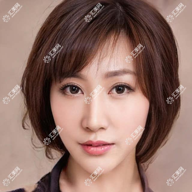 常州近视矫正医生盘点!全飞秒ICL晶体植入受网友热捧!