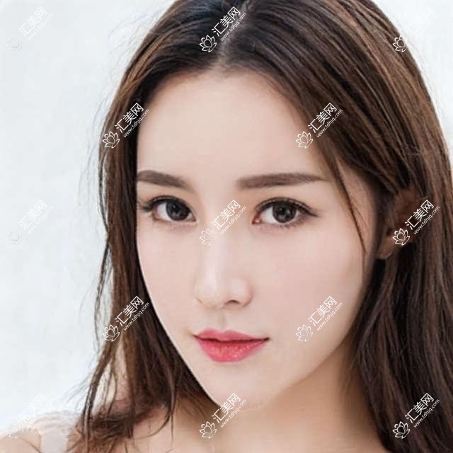 肇庆有名眼科医生力荐ICL晶体植入手术,李远标、李春光、姚永屿等医生备受信赖