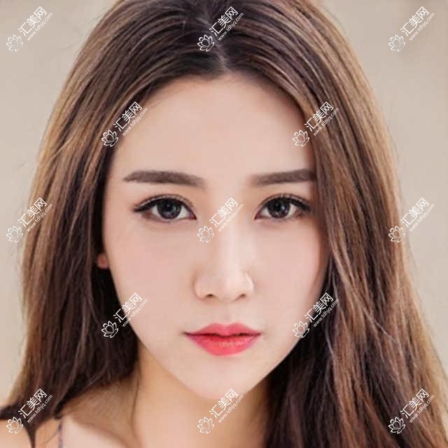 北京锦瑞口腔全项目价格揭秘:牙齿矫正美白种植一网打尽