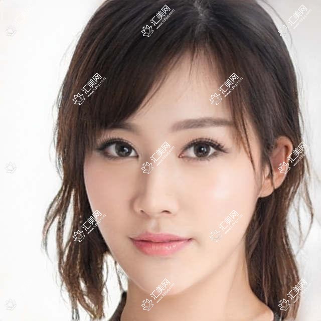 三亚眼科医生张晓琴领衔,近视矫正手术备受好评!