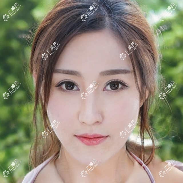到宿迁找这些正畸医生做牙齿矫正,笑容更灿烂