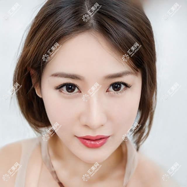 南昌市洪城爱尔眼科近视矫正费用揭秘?全飞秒亲民价/ICL晶体植入高端选/激光近视手术性价比高
