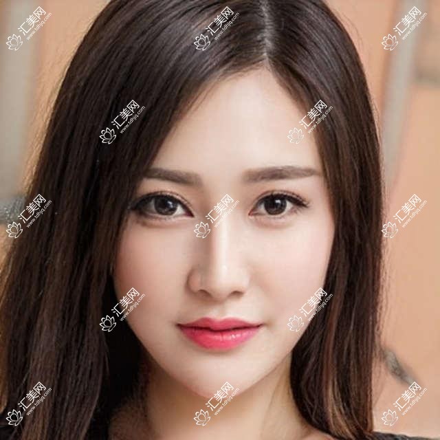 长春眼科及整形医生推荐!角膜炎结膜炎白内障治疗,眼部鼻部整形全攻略!