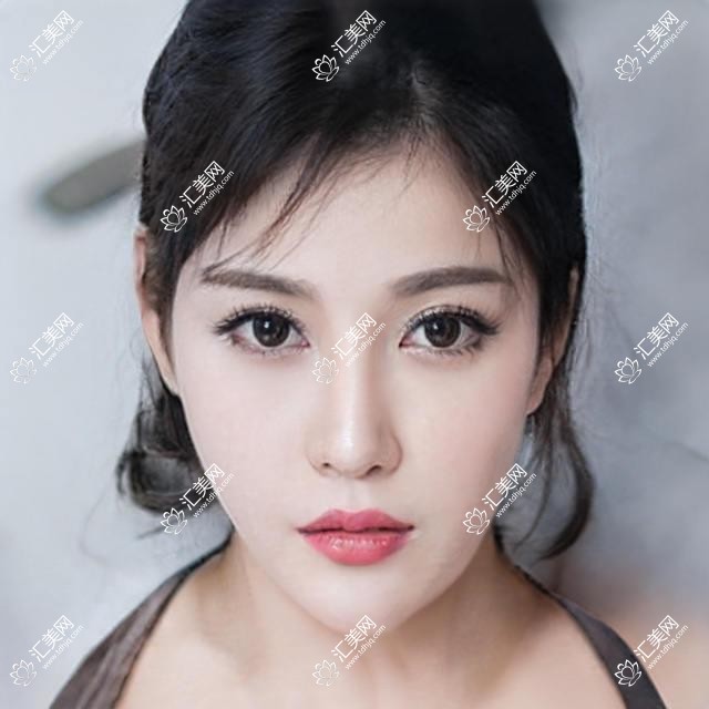 邢台地区眼科医生推荐榜:精通全飞秒近视手术医生详解(含特色+费用)_邢台眼科必看