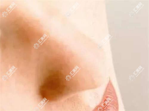 银川眼科医生李彦宋立新张青蔚近视手术及眼部整形疗效如何?