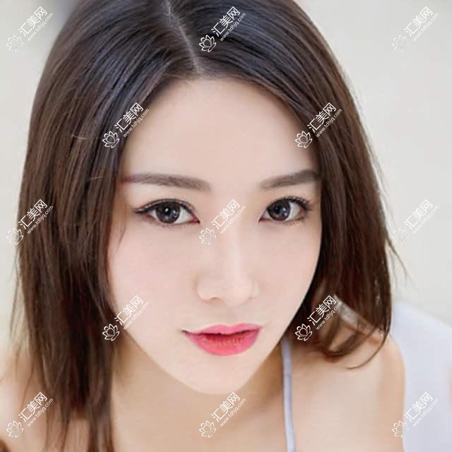 武汉悦瞳眼科项目价格揭秘：全飞秒近视手术1.5W+ 半飞秒1.2W+ 晶体植入2.8W+