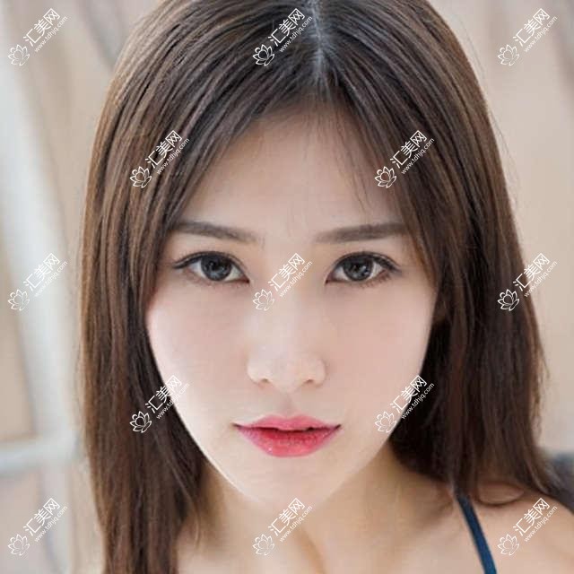 武汉悦瞳眼科门诊价格揭秘!近视手术、白内障治疗等眼科项目费用清单