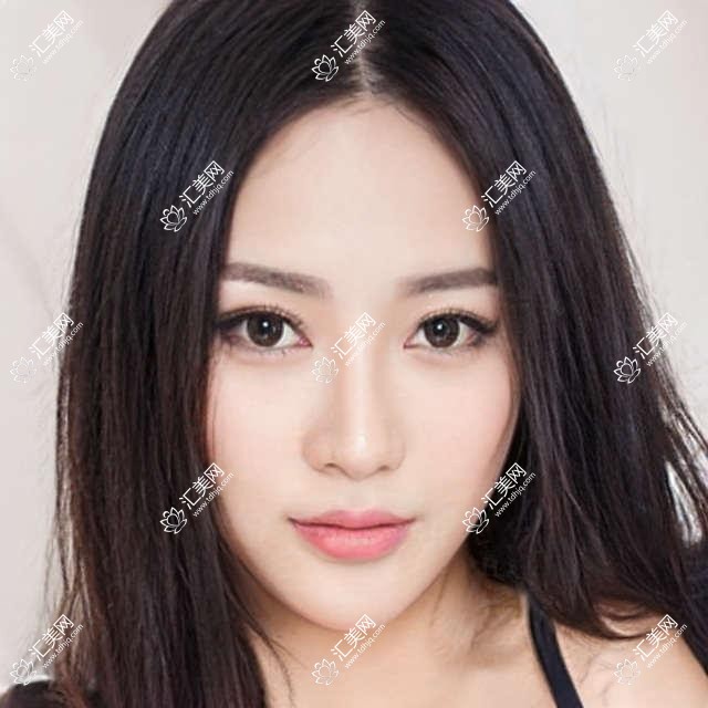 衡阳眼科医生推荐:玻璃体切割术优选医生信息揭晓