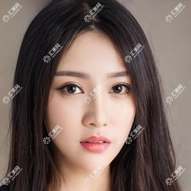 常州哪位眼科医生做近视手术受好评?陈兵、李凤芝等医生榜上有名