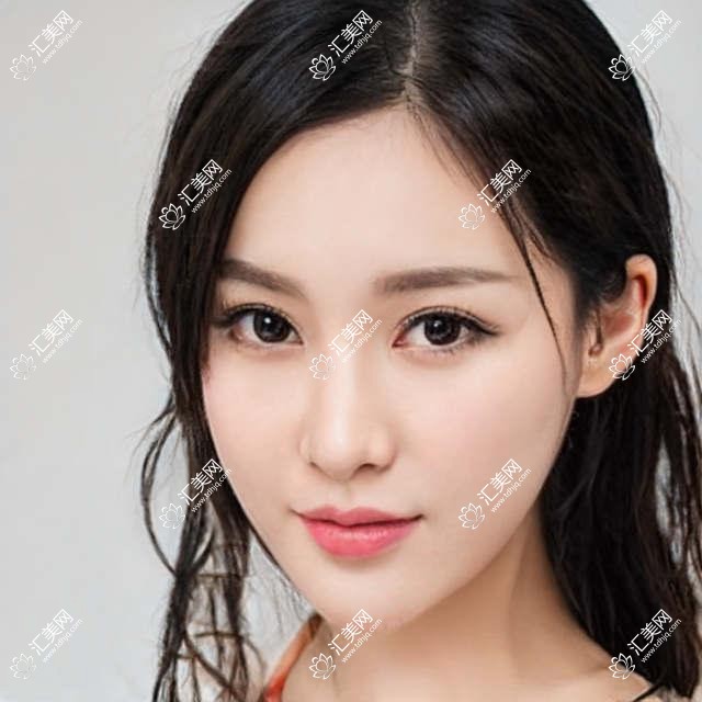 湛江白内障治疗医生李瑞庄测评,广医附院眼科口碑优选