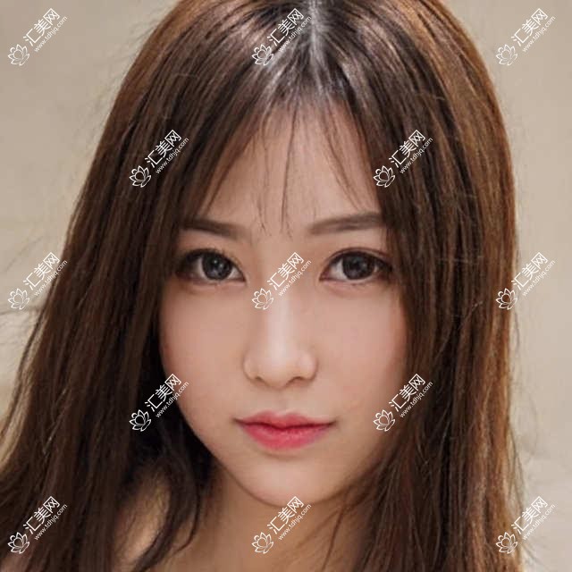 深圳佰仕口腔多面价格表:陶瓷自锁托槽矫正+全口种植牙详询,实惠价公开