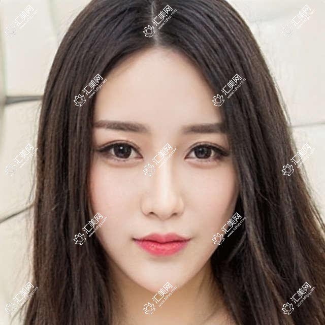 临沂眼科医生推荐:闫莹, 田作龙, 史夫艳擅长白内障及近视手术