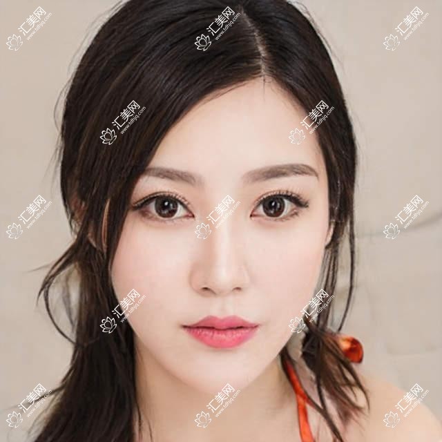 岳阳近视矫正医生排名更新!王华、孙楚雄技术获赞!