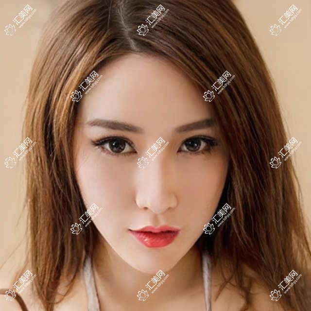北京擅长眼科手术的医生推荐有谁?翟长斌王立娟蒋晶晶等眼科医生精通近视白内障治疗