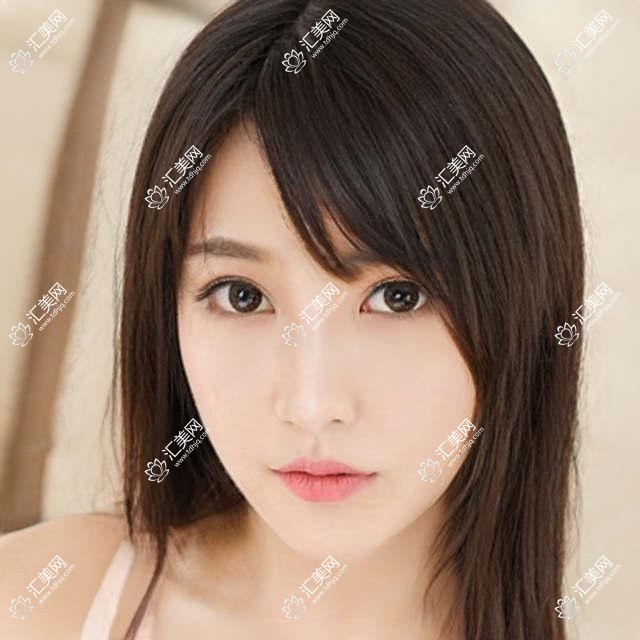 潍坊近视手术医生杨明张浩润，ICL晶体植入与激光矫正口碑佳