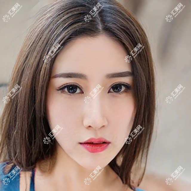 北京市和雅齿科口腔治疗费用揭秘:牙齿矫正2W+ 牙齿美白5K+ 种植牙1.5W+