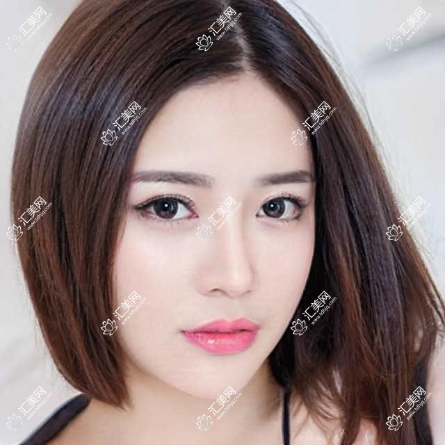 遵义牙齿矫正好评医生推荐?邢云鹏、嬴胡川、黄亮领衔