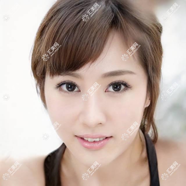 郑州近视手术医生推荐!孙彪万光明刘苏冰擅长全飞秒ICL,口碑技术双在线!