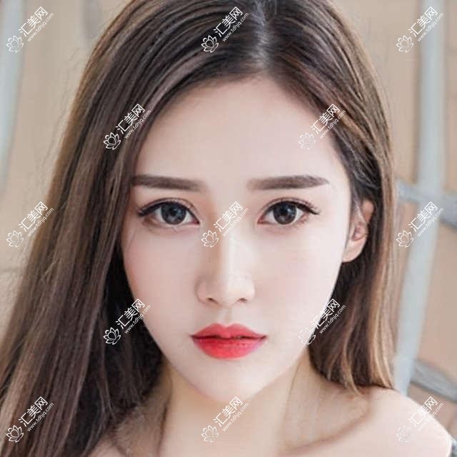 成都八处整形口腔项目价目表详解,假体隆胸等多面覆盖,费用29800元起