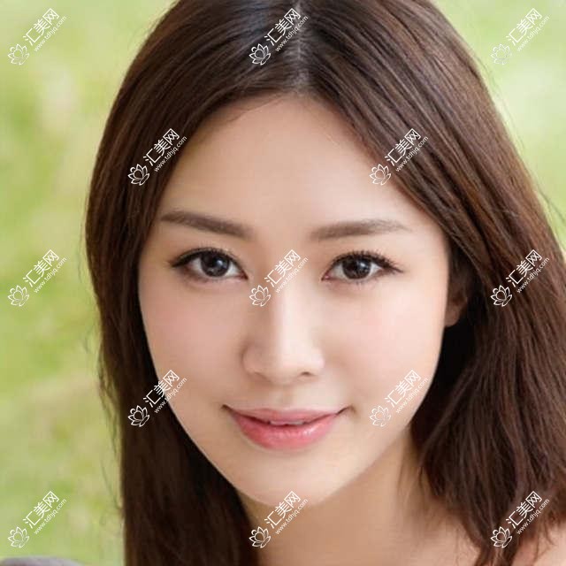 北京眼科医生推荐ICL晶体植入榜单(含特色+价格)_近视矫正优选