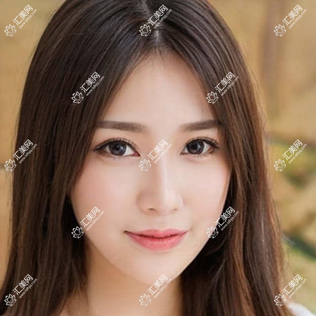 泉州眼科医生林朝斌庄建福高莹莹如何?擅长白内障及儿童近视手术推荐