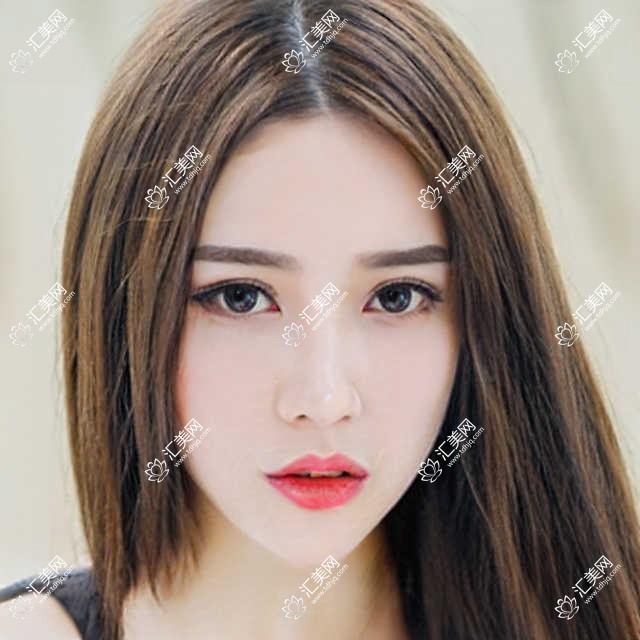 郑州奥弗克眼科全项目价格一览:近视手术+眼部治疗费用明细