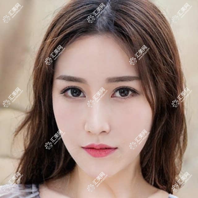 南充有名眼科及整形医生推荐!斜视近视矫正与美眼设计备受好评!