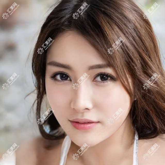 温州这些眼科医生解决眼部问题,手术疗效令人称赞
