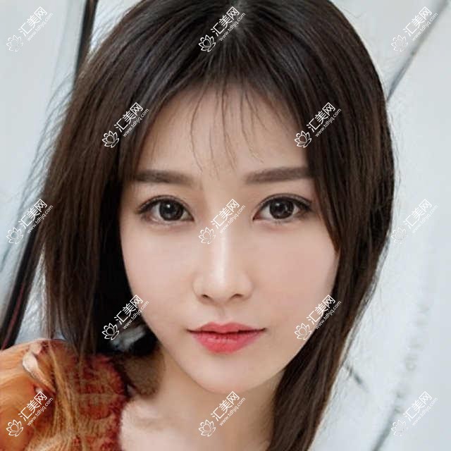 温州眼科医生方爱武陈蔚陈启伟解读,青光眼白内障治疗方案及三焦点晶体选择