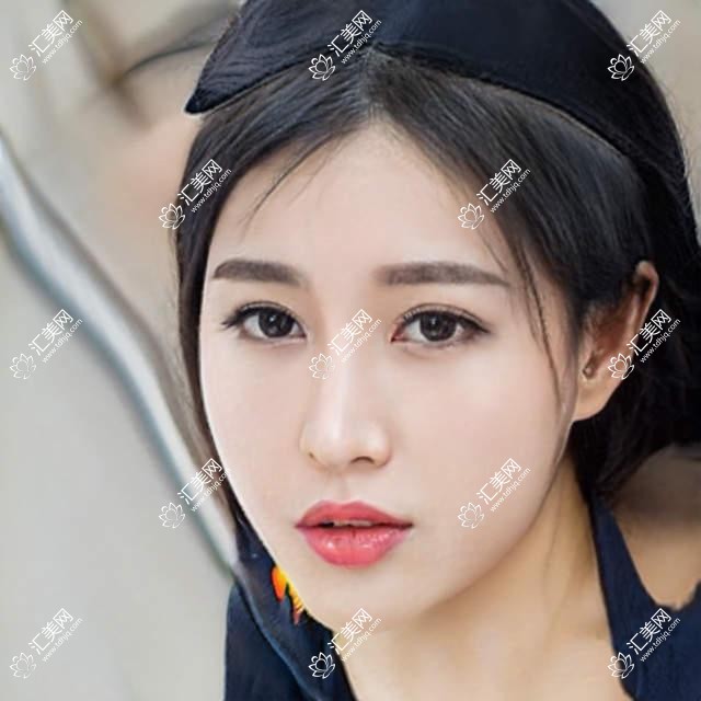 芜湖眼科医生金伟、王俊芳眼部治疗受好评!擅长白内障及近视矫正!