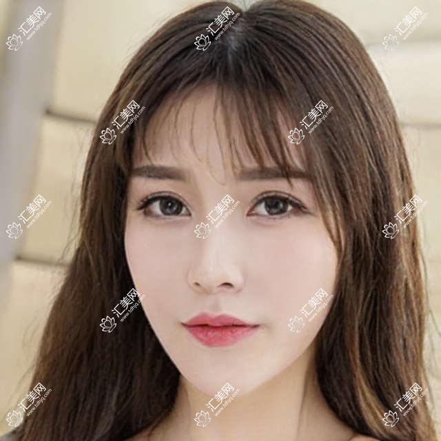南宁眼科医生排行榜(白内障 青光眼 眼部整形优选医生推荐)