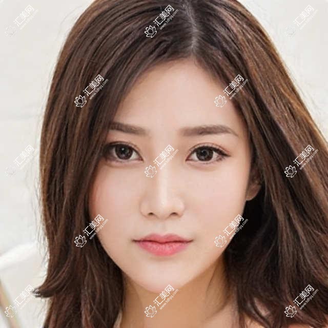 包头眼部修复医生张诚周园尹丽霞测评,精通眼部整形重塑美眸