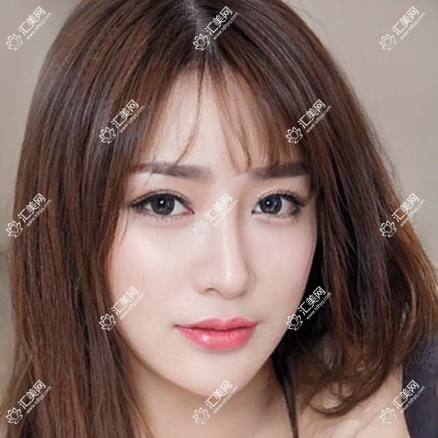 广州蓝贝壳口腔揭秘:牙齿矫正&美白&种植价格表,你想了解的都在这里!