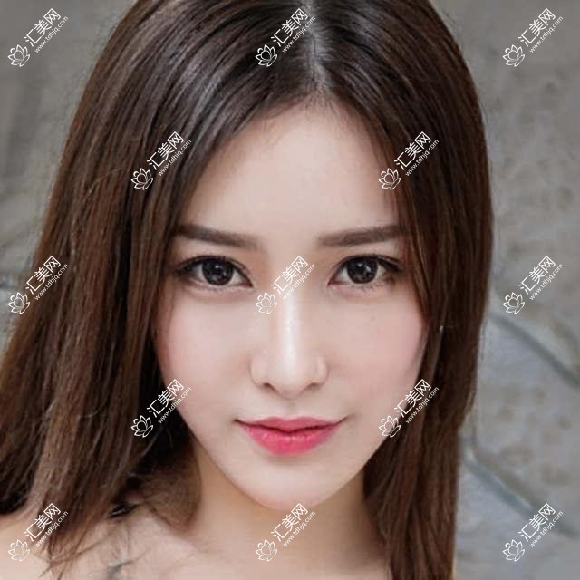 北京近视矫正医生推荐:全飞秒手术高手齐聚,介绍、价格、地点一网打尽!