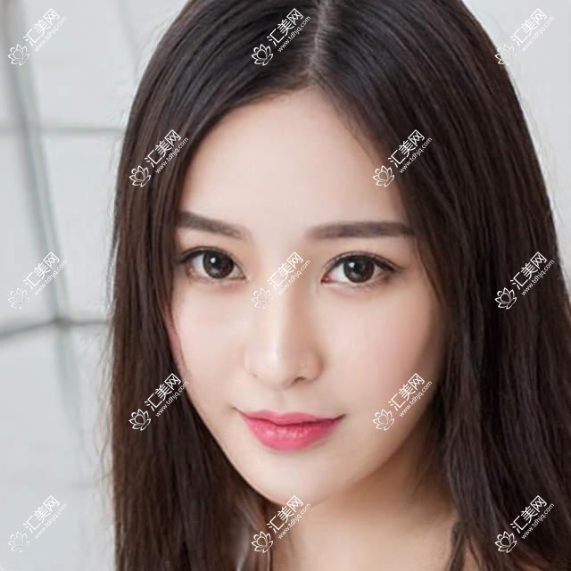 烟台地区眼科医生推荐:孙雪峰白内障手术精细,陈莉擅长抗衰老去皱,卓旭英精通儿童眼科治疗